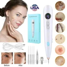 Laser Plasma Mole Removal Pen Dark Spot Remover Skin Wart Tag Tattoo Machine USB