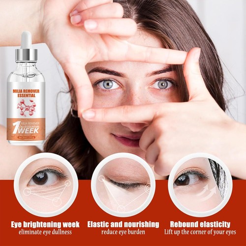 Milia Remover Spot Serum for Anti-Aging & Reduces Dark Circles - 1 PCS Genuine - Picture 2 of 7