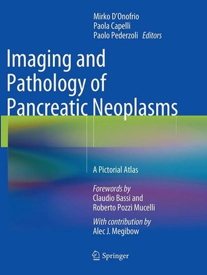Mirko D'Onofrio (u. a.) | Imaging and Pathology of Pancreatic Neoplasms | Buch