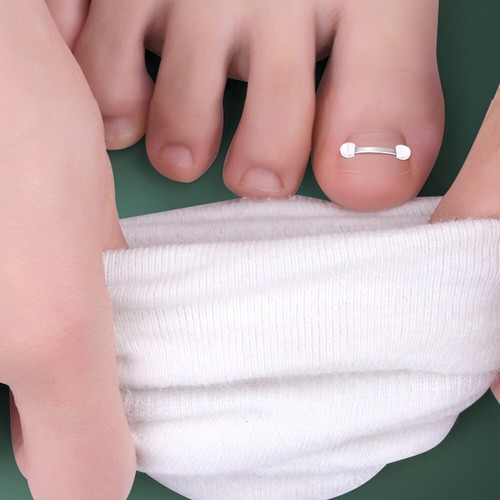 1PC Ingrown Nail Care Paronychia Cure Corrector Clip Toenail Recover Relief Pain - Picture 8 of 12