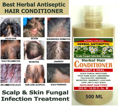 HEALTHY LIFESTYLE Treat Tinea Capitis Ringworm Warts - ANTISEPTIC HERBAL CONDITIONER 500 ML