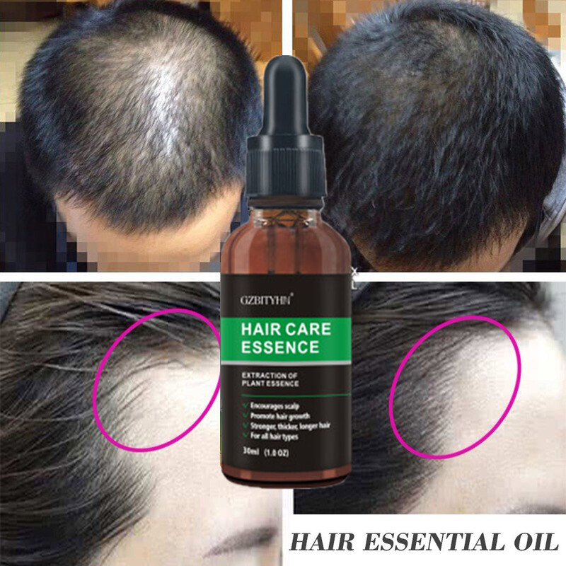 Hair Growth Oil 30 ml hair oil, hair oiling, longer hair, hair serum, hair care Hair Growth Oil 30 ml hair oil, hair oiling, longer hair, hair serum, hair care