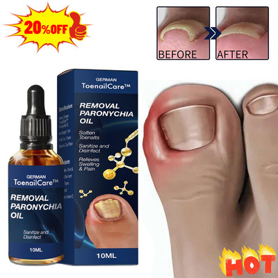 ANTI FUNGAL TREATMENT EXTRA STRENGTH TOENAIL FUNGUS FUNGI NAIL ATHLETE'S FOOTS