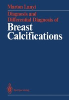 Diagnosis And Differential Diagnosis Of Breast Calcifications Marton Lanyi