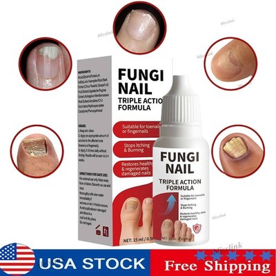 Premium Fungi-Nail Anti-Fungal Liquid Solution Kills Fungus That Can Lead To ...