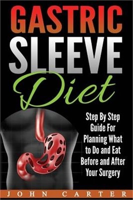 Gastric Sleeve Diet: Step By Step Guide For Planning What to Do and Eat Before a