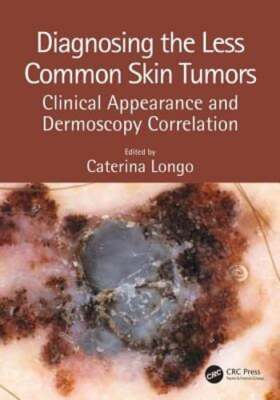 Diagnosing the Less Common Skin Tumors: Clinical Appearance and Dermoscopy: Used