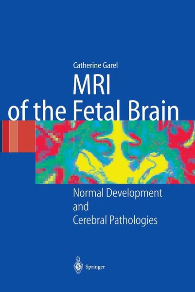MRI Of The Fetal Brain Normal Development And Cerebral Pathologies C. Garel Buch-image