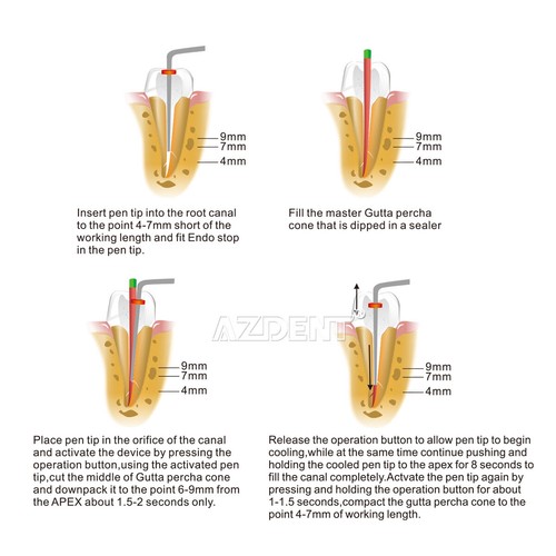 Dentale Wireless Endodonzia Gutta Perca Sistema di Otturazione Endo Penna Riscaldata + Punta - Foto 4 di 22