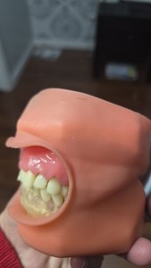 Dental Model P15DP-TRM 656 Nissin W/OCC Kilgore International