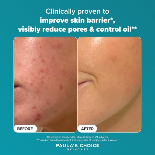 Paula's Choice 2% BHA Liquid Exfoliant 30ml 118ml | Blackheads Pores Acne - Picture 11 of 24