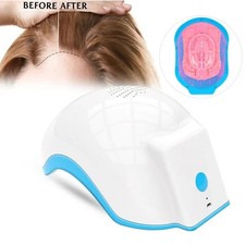 High Quality Laser Hair Growth Helmet Hair Growth Machine Treatment Hair Loss