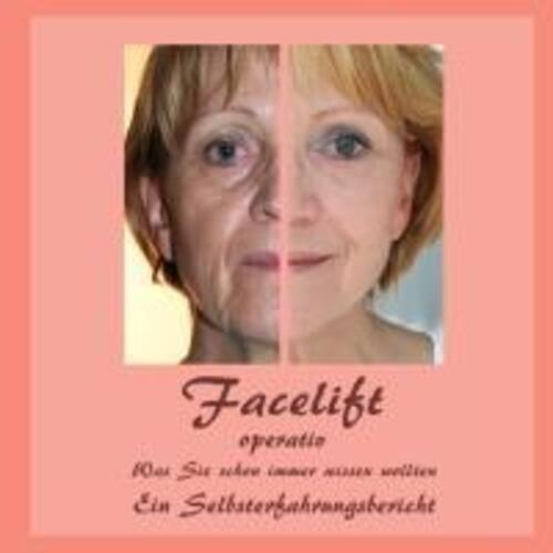 Thumbnail - Facelift Operativ | Bernhard Siegmund (u. A.) | Taschenbuch |