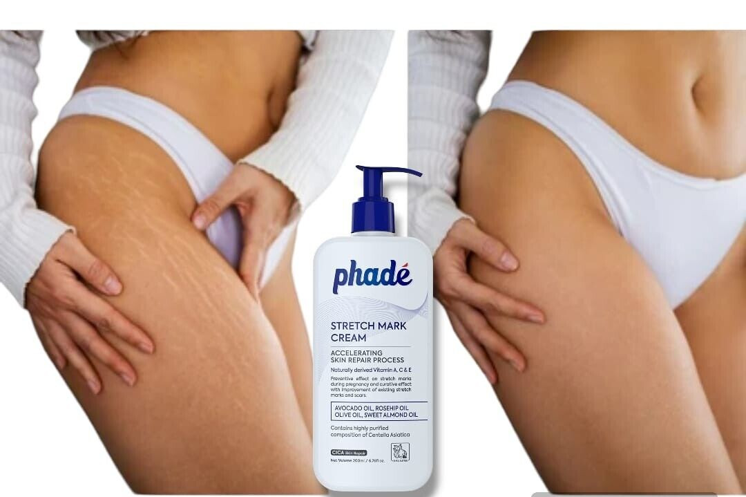 Crema de estrías Phade para el embarazo, crema de eliminación de cicatrices c...