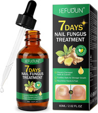 Ginger Nail Treatment & Nail Growth Strengthener Serum ? Ginger-Infused Nail Rep