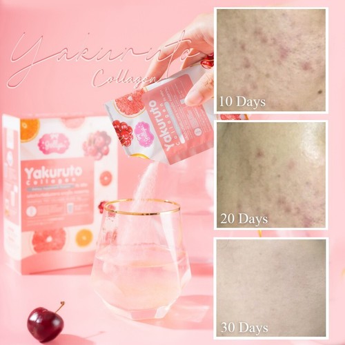3X Yakuruto Yogurt Collagen Clear Skin Reduce Acne Bounce Face Juicy Fluffy - Picture 3 of 11