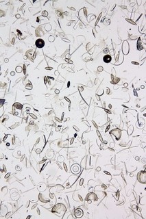 Antique microscope slide by Watson. Fossil Diatoms from South Yarra Australia.