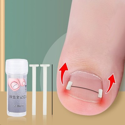 Ingrown Toenail Corrector Tools Pedicure Recover Embed Toe Nail Treatment A3