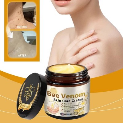 Gentle Herbal Bee Venom Skin Care Cream for Fading Moles and Cleansing the Skin
