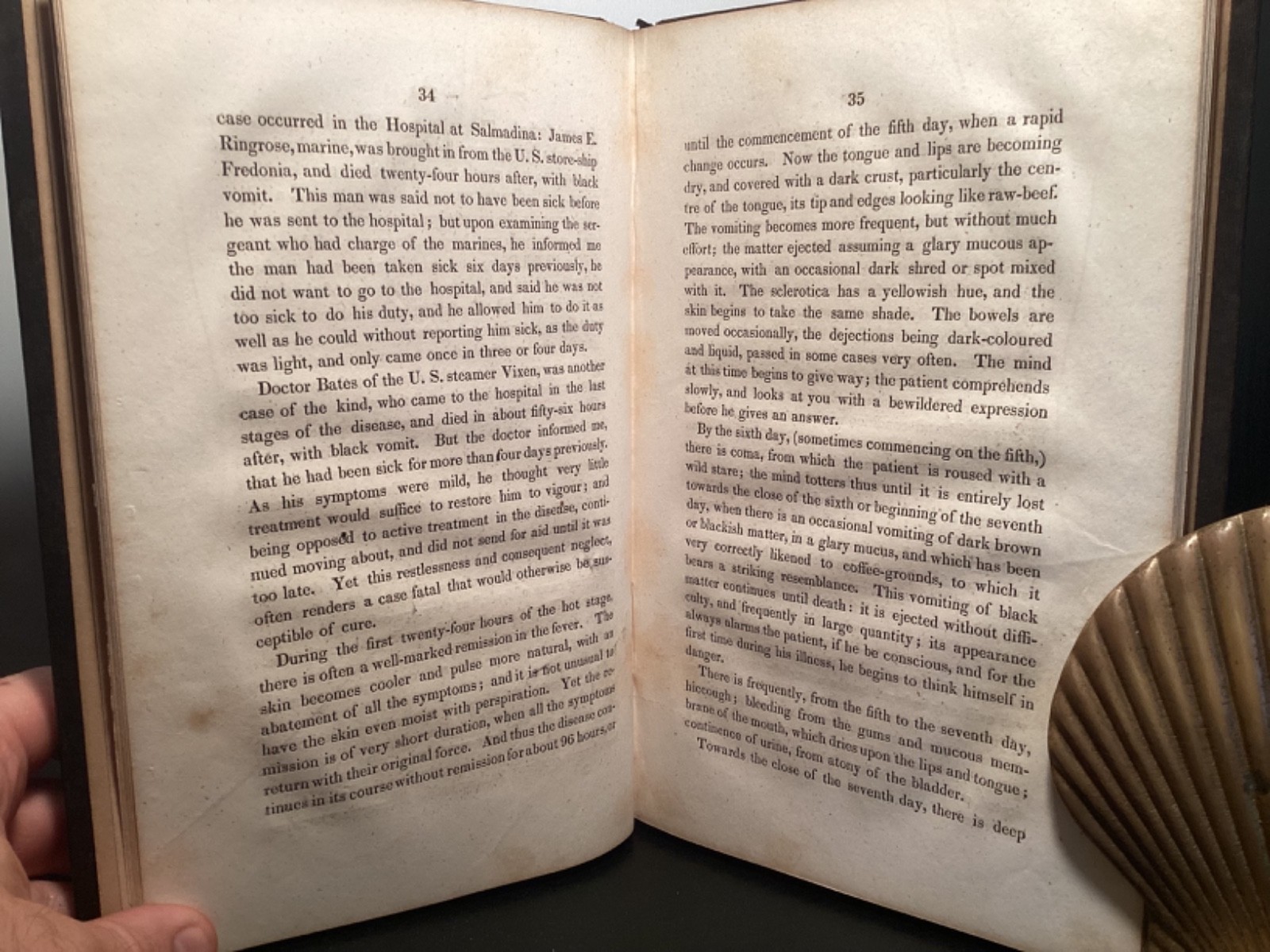 1848 Lectures On Yellow Fever - Causes, Pathology, & Treatment - John Hastings