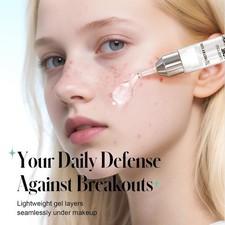 Acne Treatment Serum with 2 Salicylic Acid 10ml 