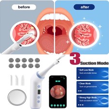 Electronic Vacuum Tonsil Stone Remover Kit LED Light 3 Mode Tonsil Stone Cleaner