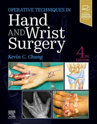 Kevin C. Chung | Operative Techniques: Hand and Wrist Surgery | Buch | Englisch