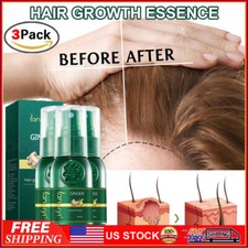 3PCS Ginger Hair Growth Spray Anti Hair Loss Fast Regrowth Scalp Treatment Serum