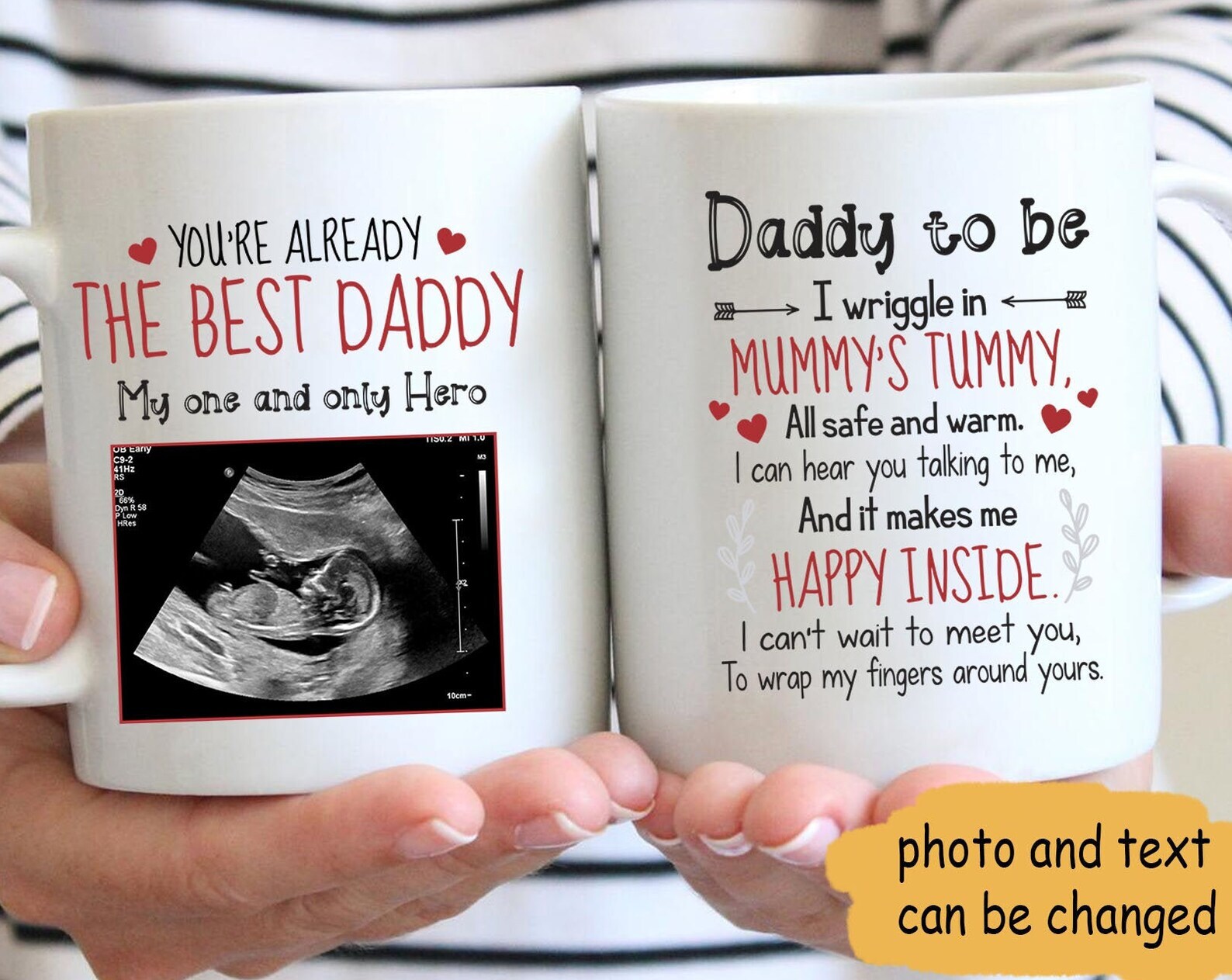 You Re Already The Best Daddy Personalized Mug Ultrasound Photo Mug Fathers Day