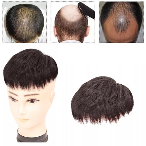 Synthetic Wig Top Wig Synthetic Fiber Top Hair Patch Men's Wig Lncrease Hair - Picture 4 of 9