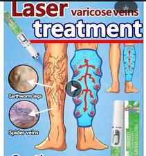 BELLEZZA SALUTE TRATTAMENTO LASER VENE VARICOSE OTTIMO RISULTATO PHOTOTHERAPY