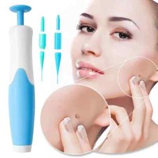 2-8 mm Auto Micro Skin Tag Remover Device Kit Safe Painless Removal Band Tool