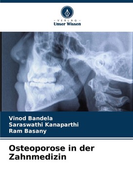 Vinod Bandela (u. a.) | Osteoporose in der Zahnmedizin | Taschenbuch | Deutsch