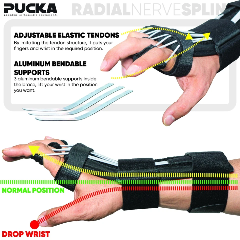 Radial Nerve Palsy Splint Adjustable Dynamic Drop Wrist and Finger Splint - Image 2 of 4
