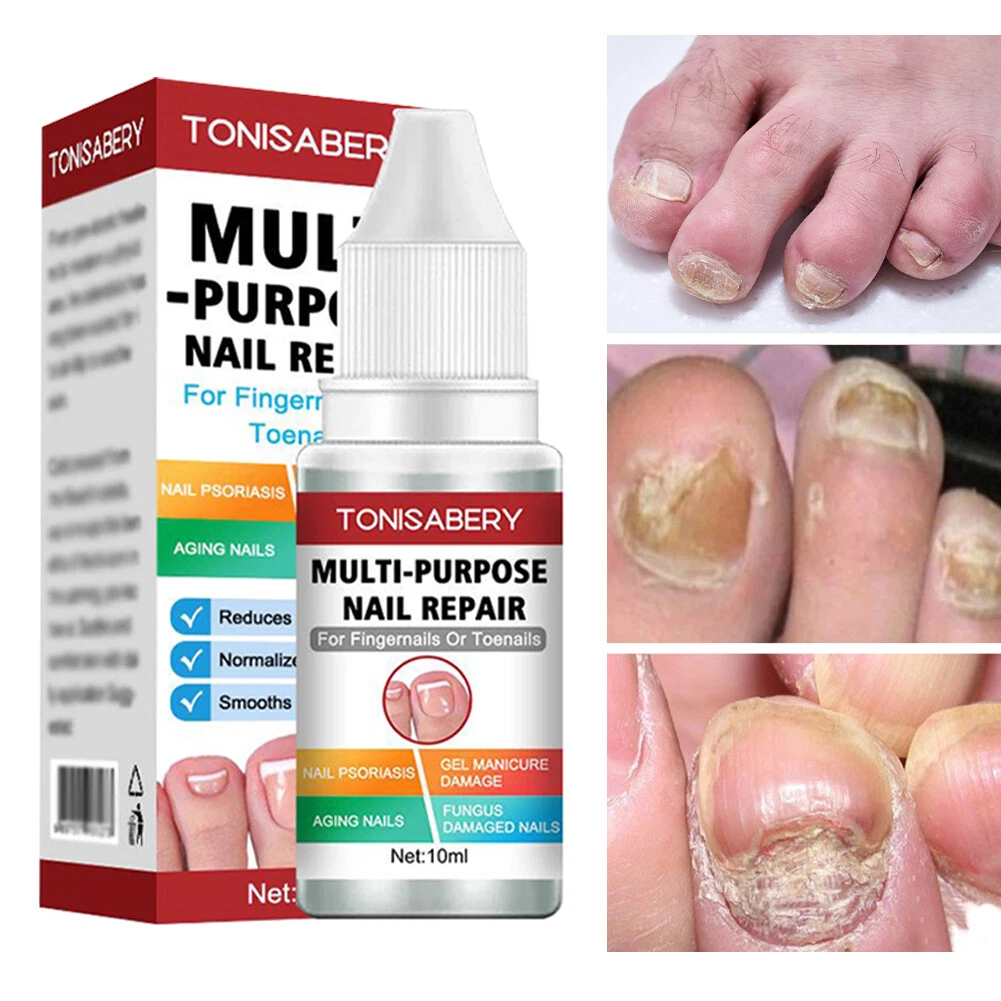 Aggregate 145+ aging nails treatment latest ceg.edu.vn