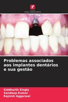 Siddharth Singla (U. A.) | Problemas Associados Aos Implantes DentáRios E Sua...