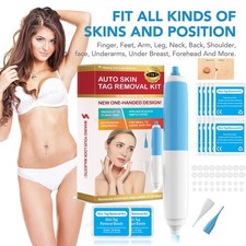 Painless Skin Tag Mole Wart Removal Kit, Auto SKIN TAG Bands Remover Pen Sets US