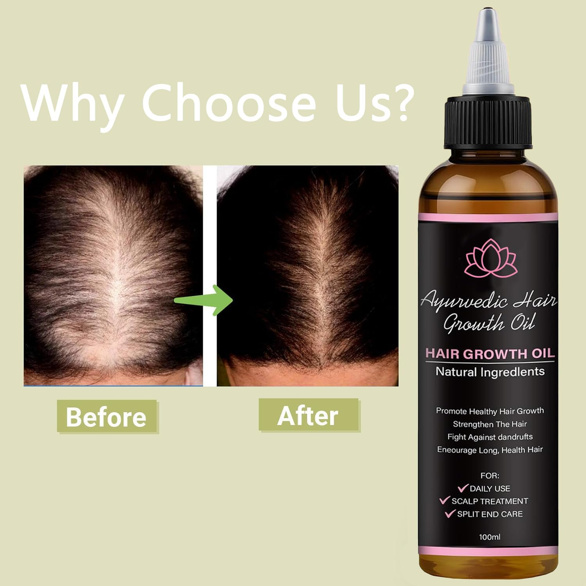 Lifewitqueenp Hair Care Growth Oil, Queenp Ayurvedic Hair Growth Oil,  Lightweigh