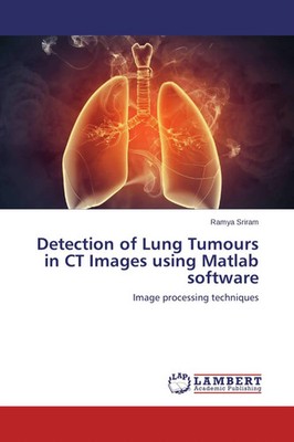 Ramya Sriram | Detection of Lung Tumours in CT Images using Matlab software