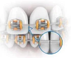 100pcs Dental Orthodontic SS Crimpable Stops for Round Archwires, Mini