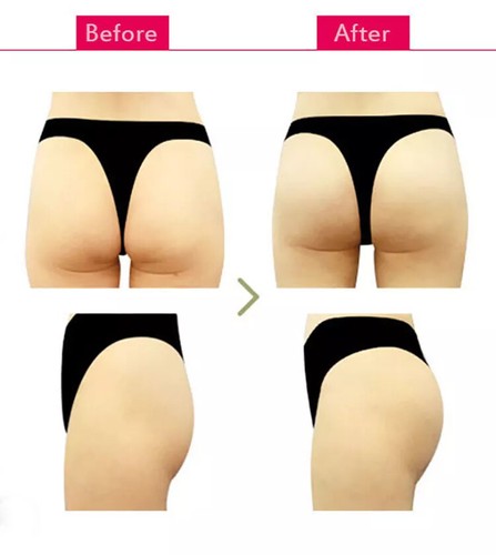 Breast Butt Enlargement Enhancement Capsules Cleavage Firming Lifting Tighten - Picture 4 of 11