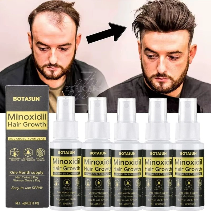 5X Minoxidil 5% Extra Strength for Men Hair Regrowth Treatment Topical Solution
