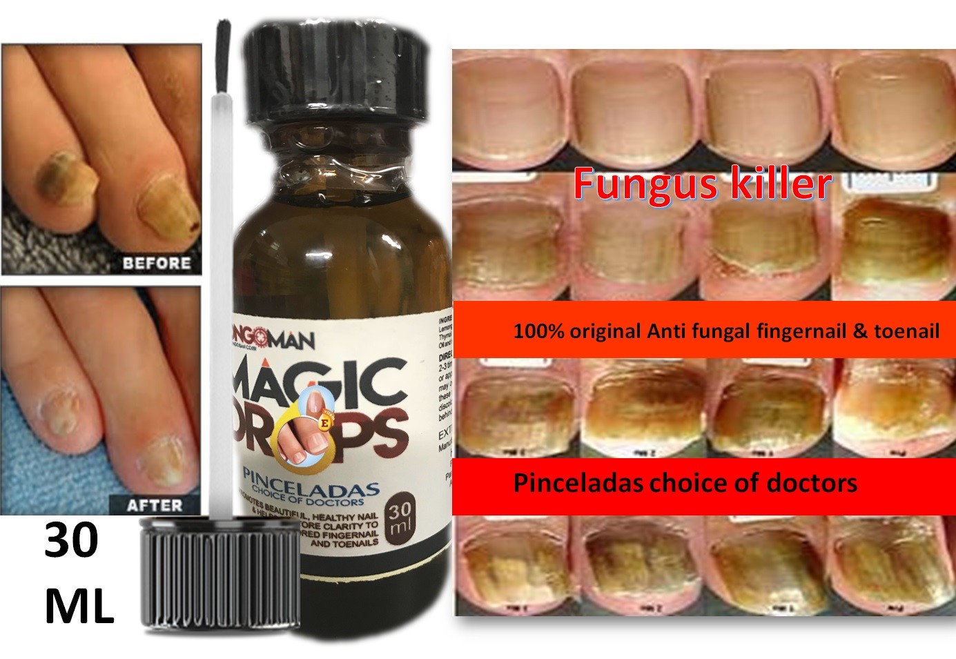 nail fungus Support Athletes foot fungus toe Zana skin nail quick eBay