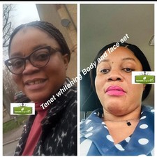 BEST SELLER WHITENING MILK BABY CREAM(30ML) VERY GOOD FOR DARK SPOTS AND SUNBURN