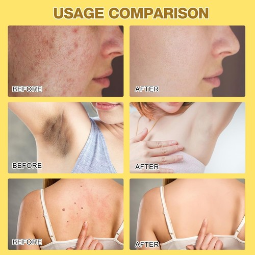 2Pcs Bee Venom Treatment Cream, 2024 New Professional Bee Venom Repair Cream,New - Picture 12 of 15