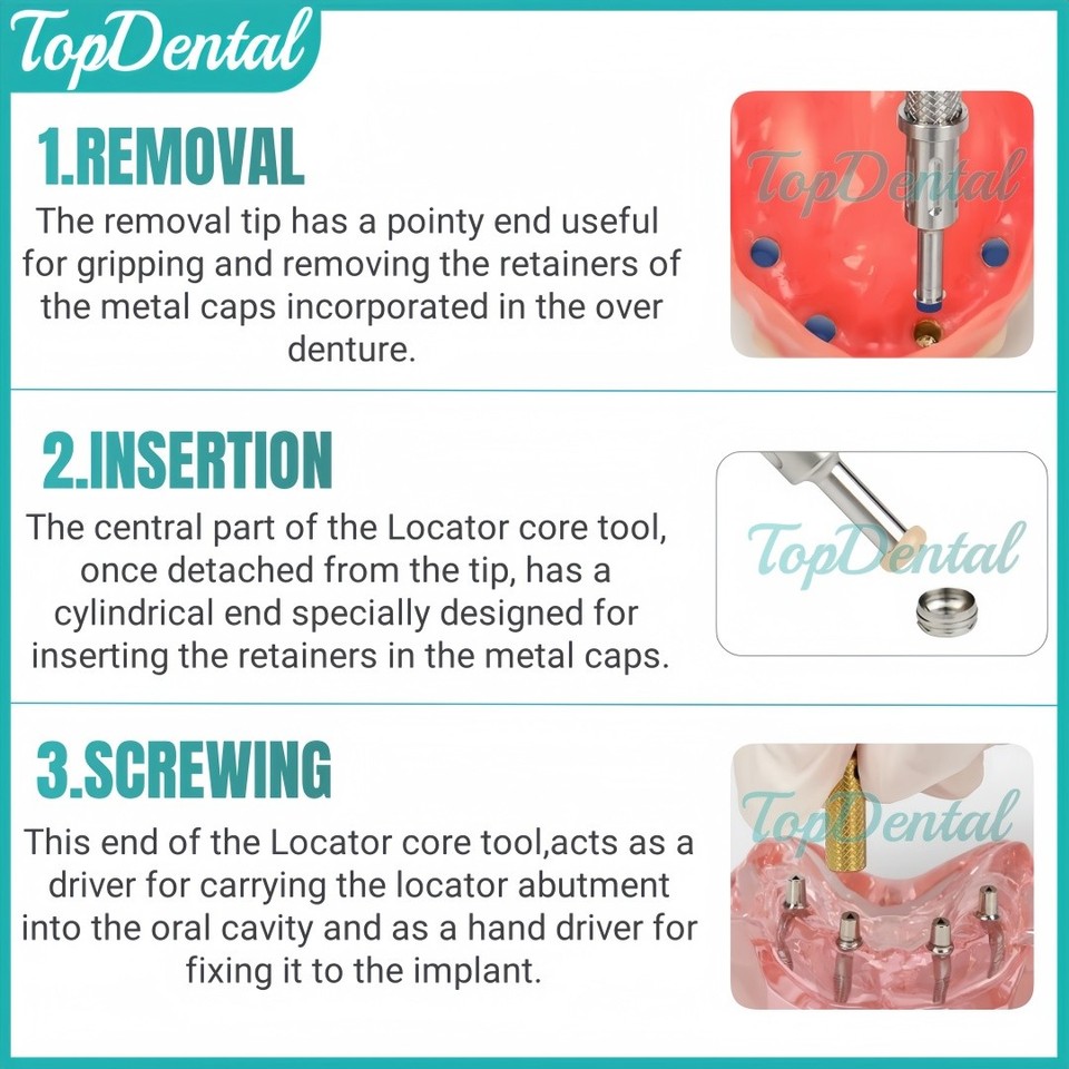 Dental Universal Implant Retention Caps Insertion Extraction Locator ...