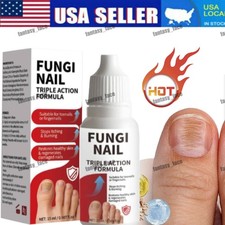 Fungi-Nail Anti-Fungal Liquid Solution Kills Fungus That Can Lead To Nail