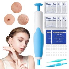 2in1 Warzenentferner Kit Warzenmittel Warze P...