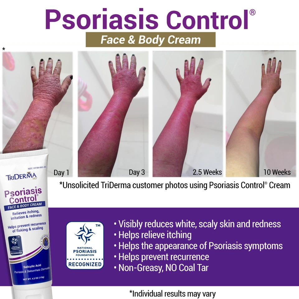 TriDerma Psoriasis Control Face & Body Cream - FSA Eligible, 4.2 oz - 4-Pack - Image 2 of 4