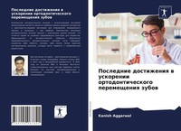 Poslednie Dostizheniq W Uskorenii Ortodonticheskogo Peremescheniq Zubow Kanish A